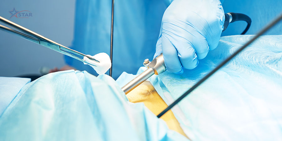 Advanced Laparoscopy, General & Cancer Surgery